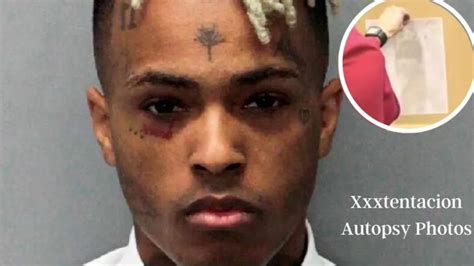 xxx autopsy leak|Real Death Videos 